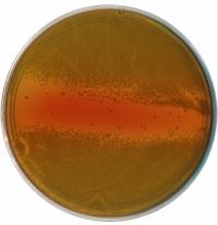 MRSA in Petri Dish