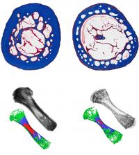 Lower Bone Density