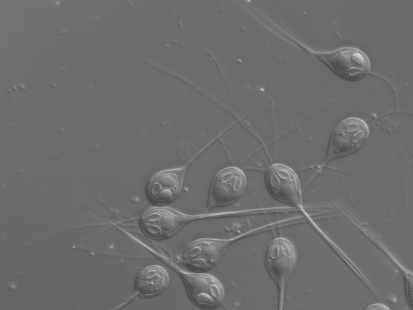 Light microscope image of spores of the parasitic cnidarian Henneguya salminicola, from Chinook salmon.