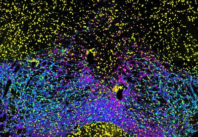 Dopamine Neurons