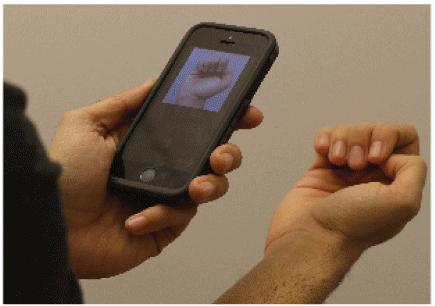 Fingernail Anemia Detection