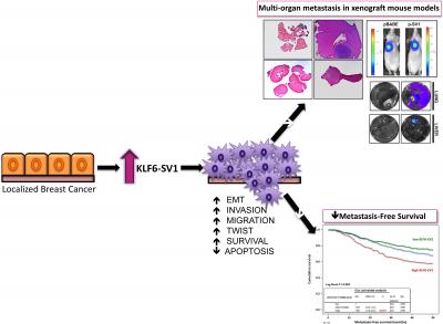 Clues to Early Breast Cancer Spread (1 of 1)