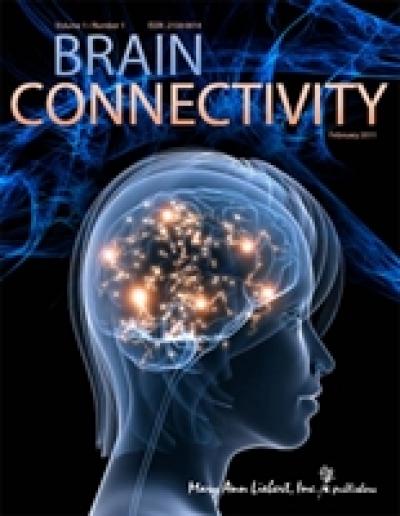 Brain Connectivity