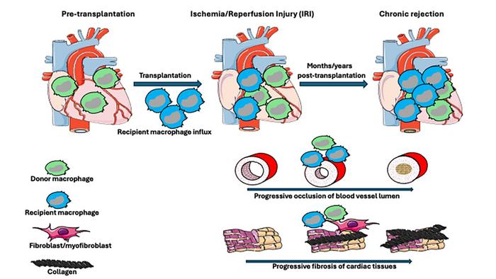 Macrophages in chronic rejection