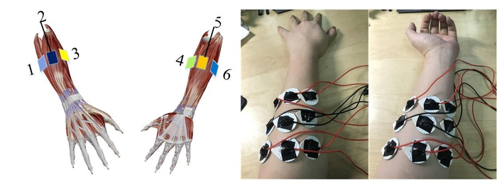 Acquisition of surface EMG signals