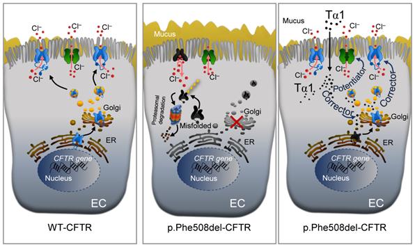 Effect of Thymosin &#945;1 in Cystic Fibrosis