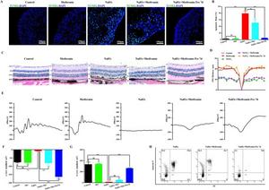 Metformin rescued RO and mouse retinal function after NaIO3 induction.