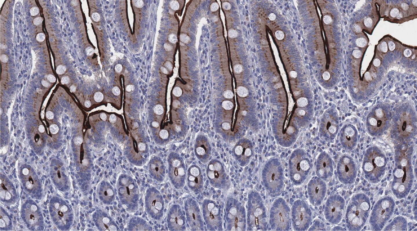 ACE2 Expressed in the Small Intestine