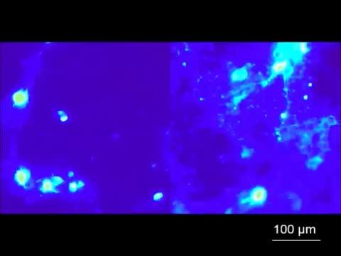 Deep Brain Stimulation with Heat and Magnets (2 of 2)