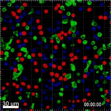 NK Cells and Antibodies