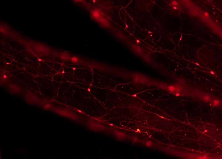 Tentacles of Nematostella