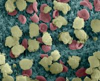 Neutrophils