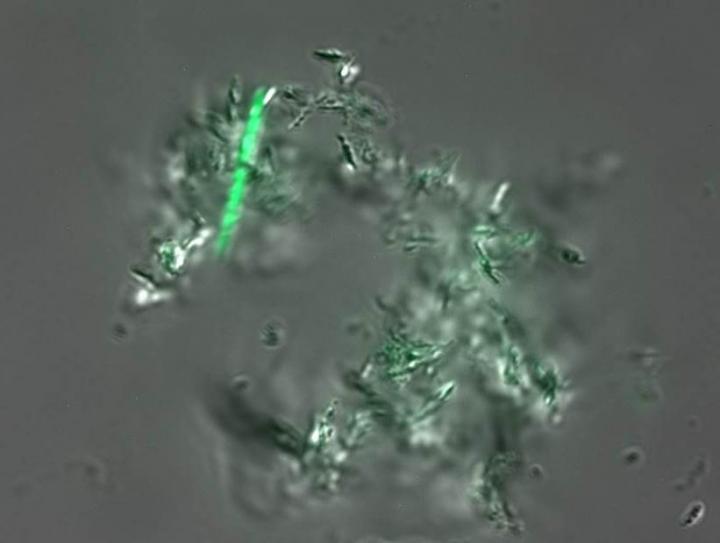 Simple New Test Could Improve Diagnosis of Tuberculosis in Developing Nations