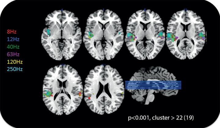 Activation of Auditory Cortex