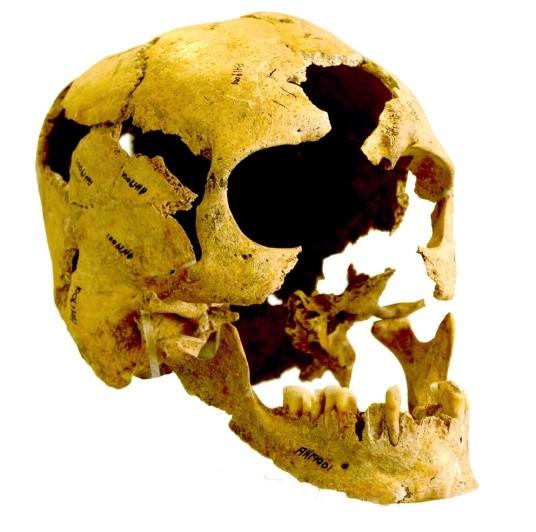Skull