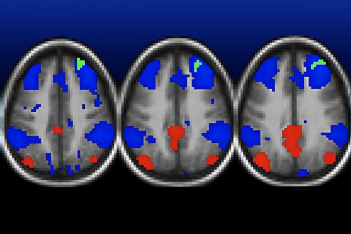 Functional MRI Scans