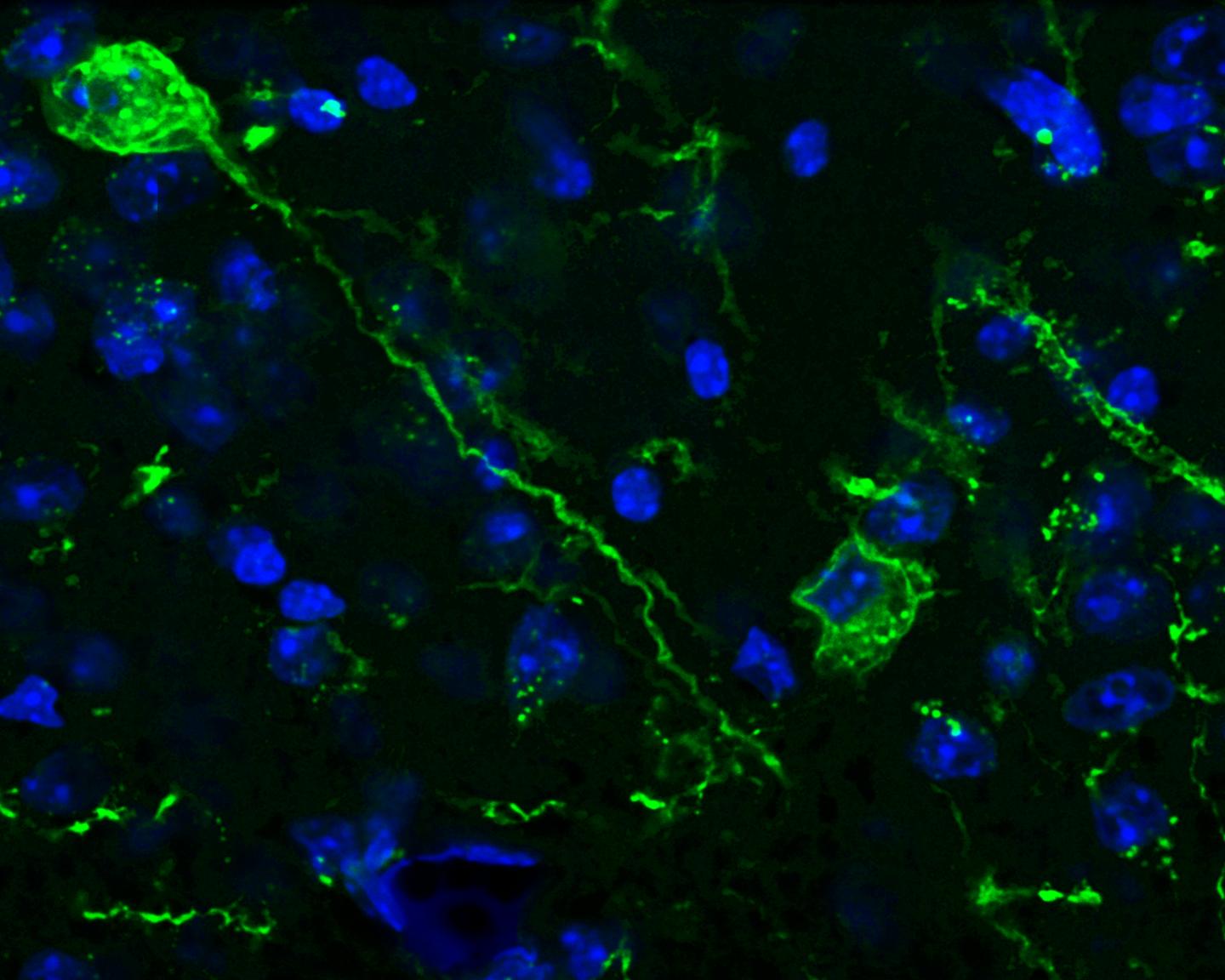New Study of the Memory Through Optogenetics