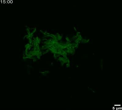 Fluorescent Probe Sheds Light on Tuberculosis Bacteria (1 of 2)