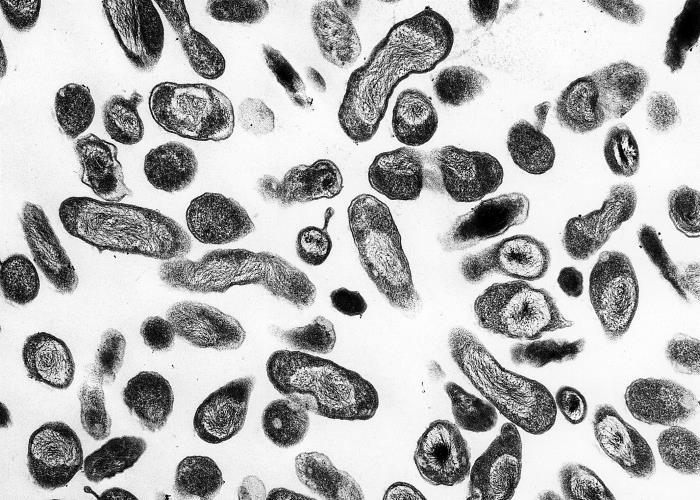 <em>Coxiella burnetii </em>Bacteria Which Causes Q Fever