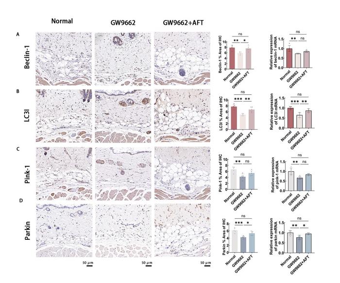 Fat grafting reverses fibrosis in dermal adipose dysfunction by restoring tissue architecture