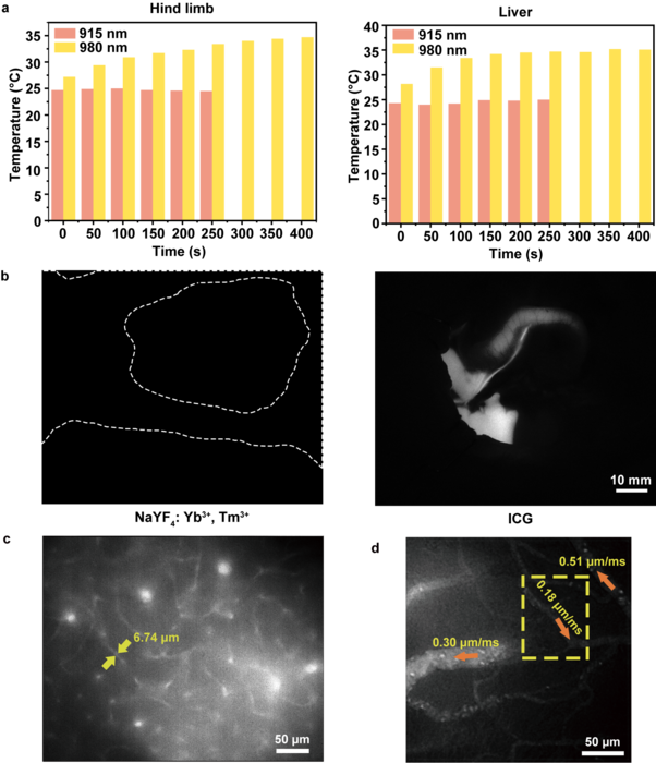 Comparison of the ASF performance of ICG and NaYF4: Yb3+, Tm3+ (UCNPs) and using ICG’s ASF in cerebral vascular tomography and flow velocity measurement
