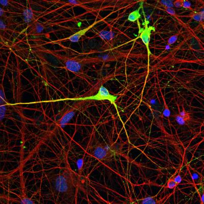 A Novel Tool Confers Targeted and Stable Editing of the Epigenome in Human Stem Cells