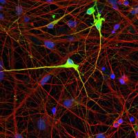 A Novel Tool Confers Targeted and Stable Editing of the Epigenome in Human Stem Cells