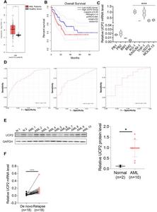 UCP2 acts as a potential prognostic marker in AML.