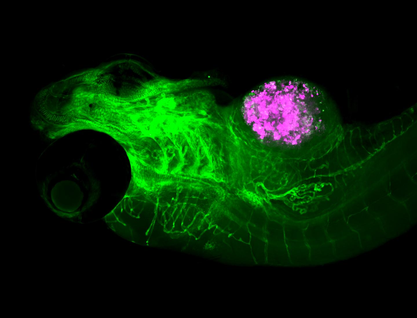 Zebrafish 'Avatars' Can Help Decide Who Should Receive Radiotherapy Treatment