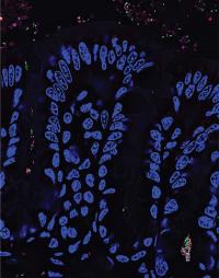 Luminal and Crypt Bacteria