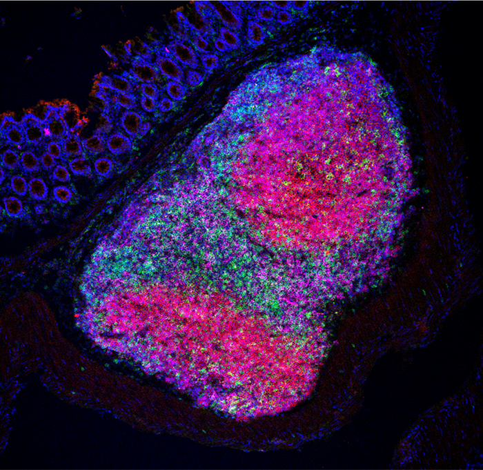 Fluorescent image of tertiary lymphoid structures in the mouse colon colonized with Helicobacter hepaticus