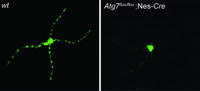 Autophagy Mediates A&#946; Secretion