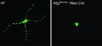 Autophagy Mediates A&#946; Secretion