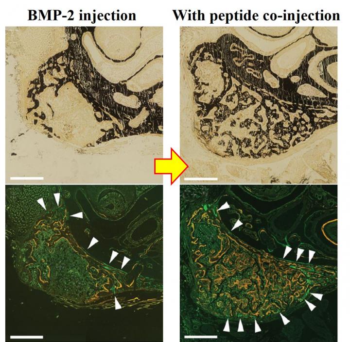 Microscopic Views of Newly Formed Bone