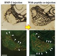 Microscopic Views of Newly Formed Bone