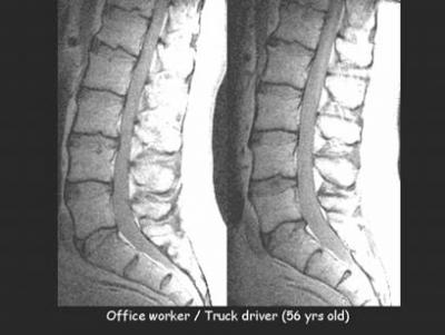 Twin Spine Study