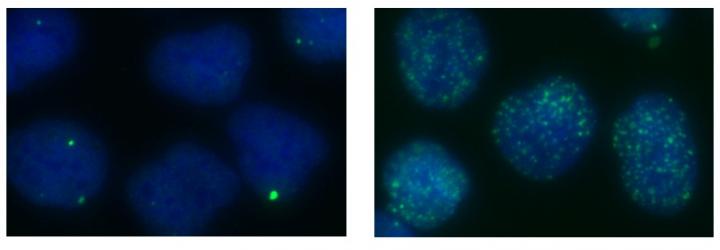 New Function for DNA Repair Protein