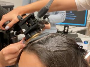 Ultrasound stimulation