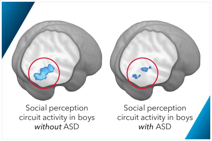 Brain Scans Showing Social Perception Circuit Activity in Boys