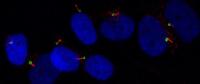 Primary Cilia in Human Cartilage Cells