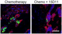 Yibin Kang's New Weapon Against Cancer