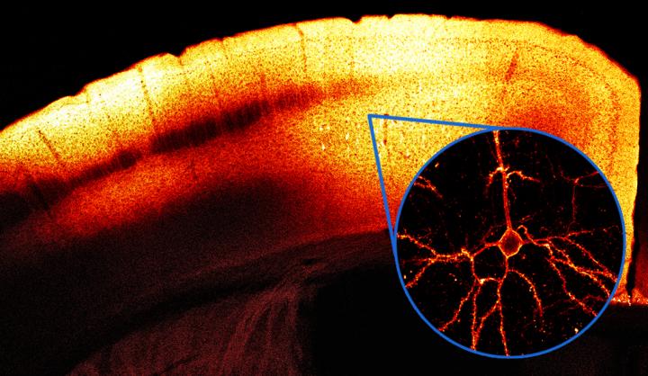 VARNAM Expressed in Motor Cortex of Mouse Brain