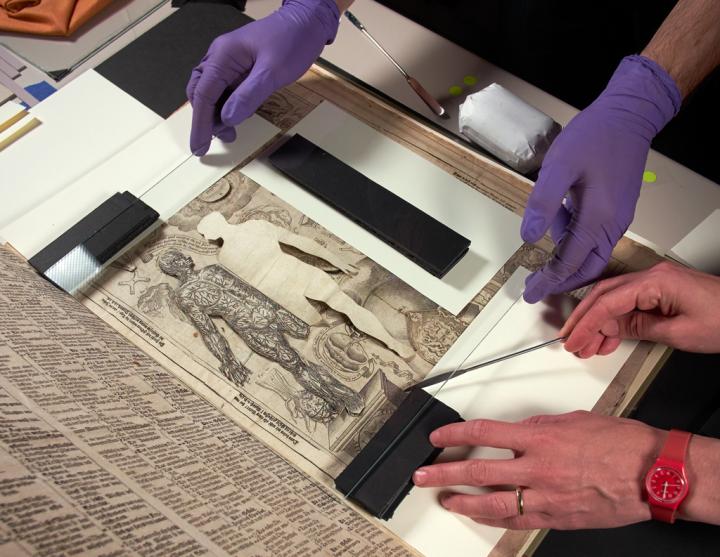Digitizing a Medical Pop-Up Book (1 of 2)