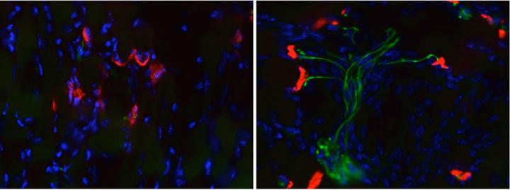 SMA Motor Neurons