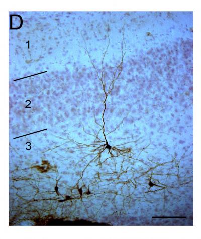 Stem Cell-Derived Neuron