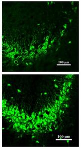TXM-CB3 attenuates seizure-induced neuronal cell death