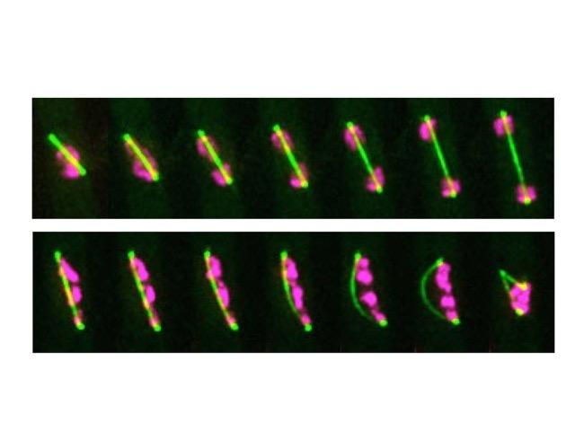 New Appearance Seen in Fission Yeast Following ICRF-193 Treatment