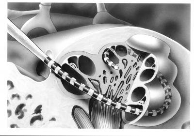Cochlea