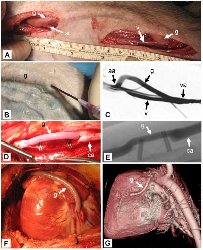 Growing Blood Vessels to Save Lives (4 of 6)