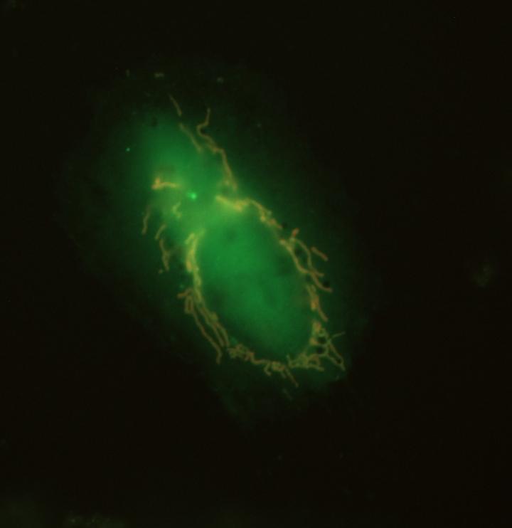 NIPSNAP1 in and on Mitochondria